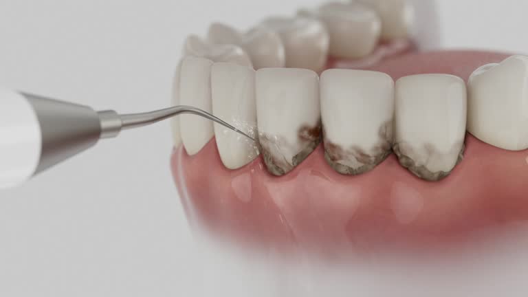 Reliable Teeth Whitening contractor in Kay County County, OK by Dentist Open Now